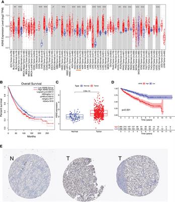 ASNS can predict the poor prognosis of clear cell renal cell carcinoma